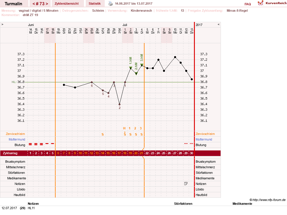 NFP-Kurve User #13733