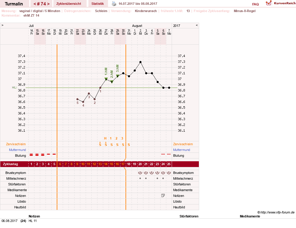NFP-Kurve User #13733