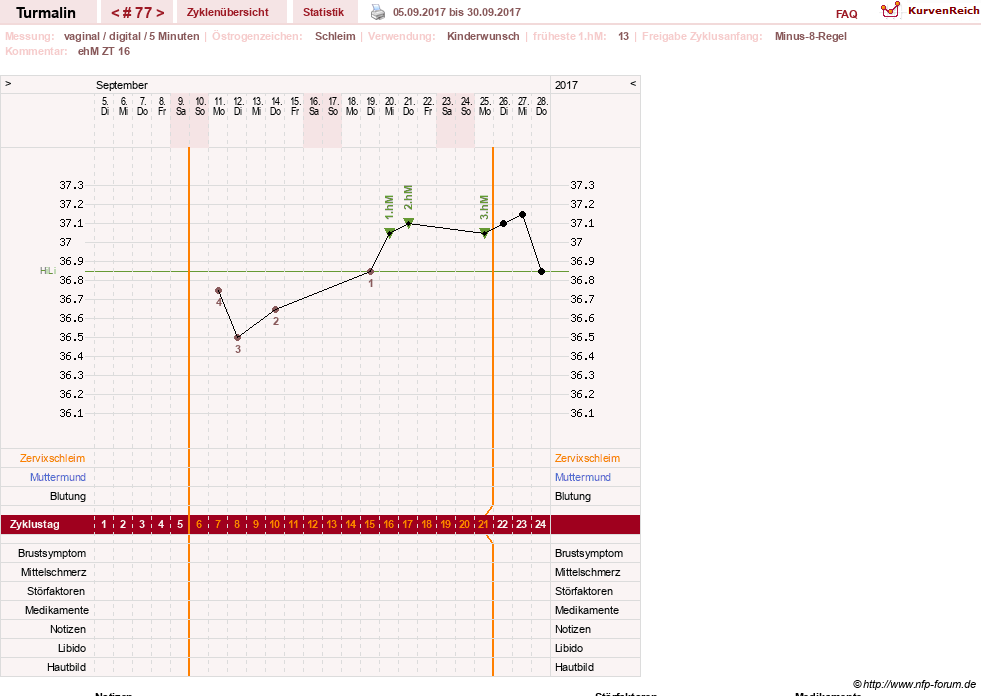 NFP-Kurve User #13733