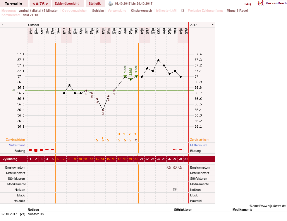 NFP-Kurve User #13733