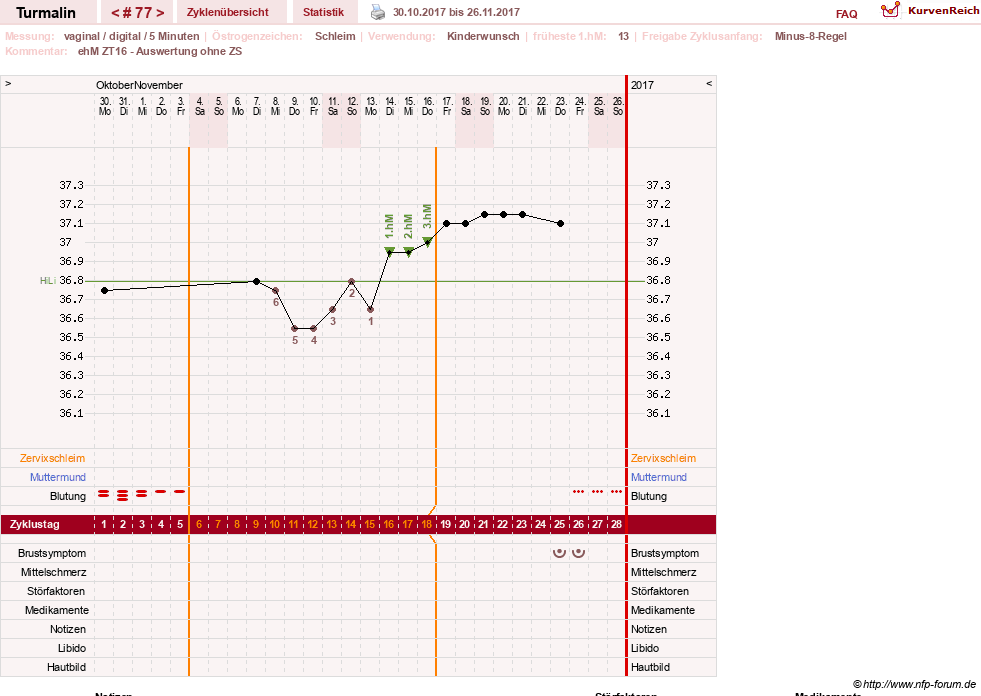 NFP-Kurve User #13733