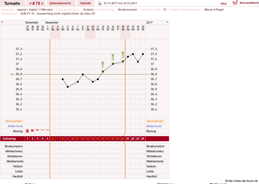 NFP-Kurve User #13733
