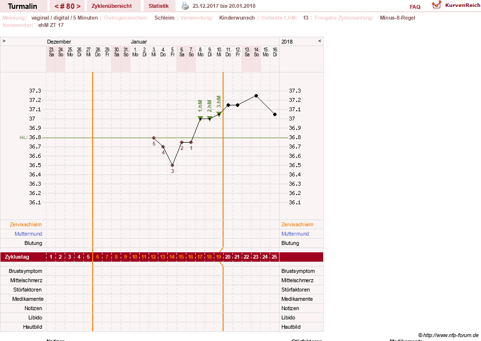 NFP-Kurve User #13733