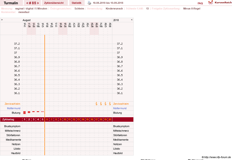 NFP-Kurve User #13733