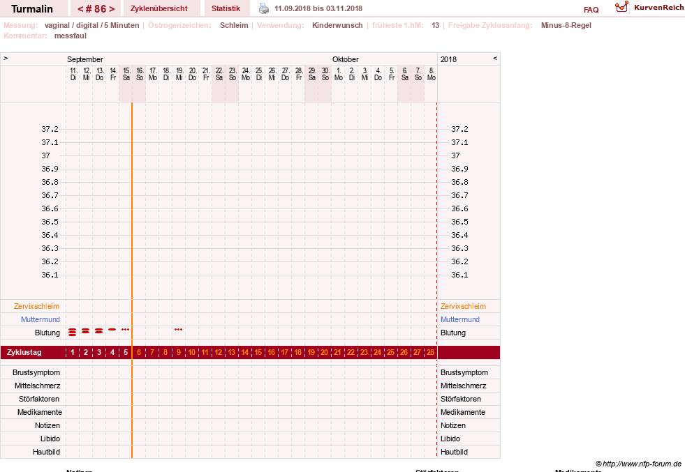 NFP-Kurve User #13733