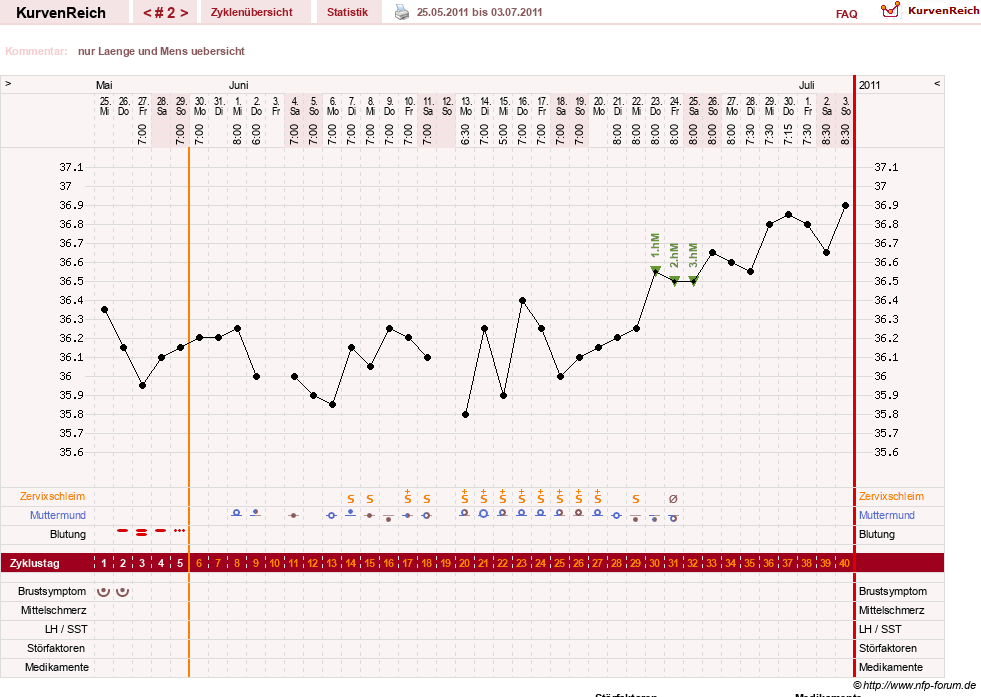 NFP-Kurve User #13742