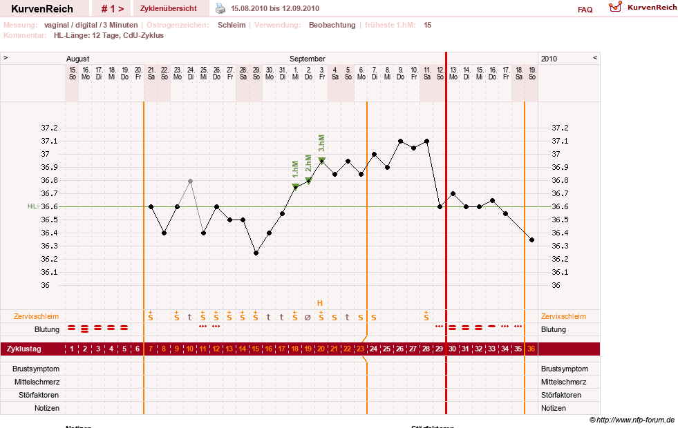 NFP-Kurve User #13804