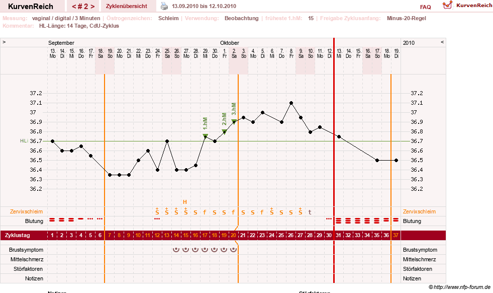 NFP-Kurve User #13804