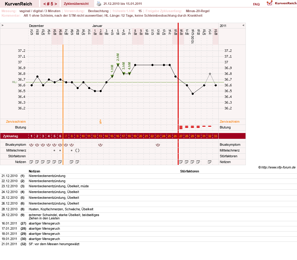 NFP-Kurve User #13804