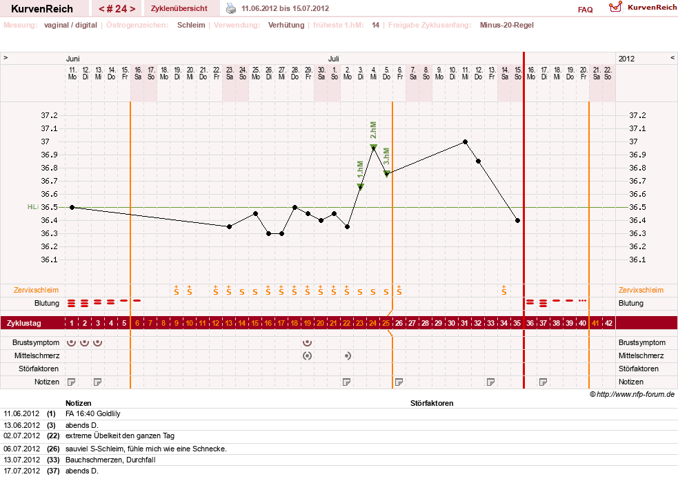 NFP-Kurve User #13804