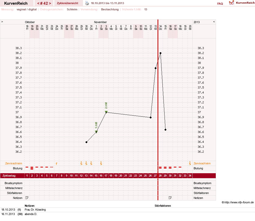 NFP-Kurve User #13804