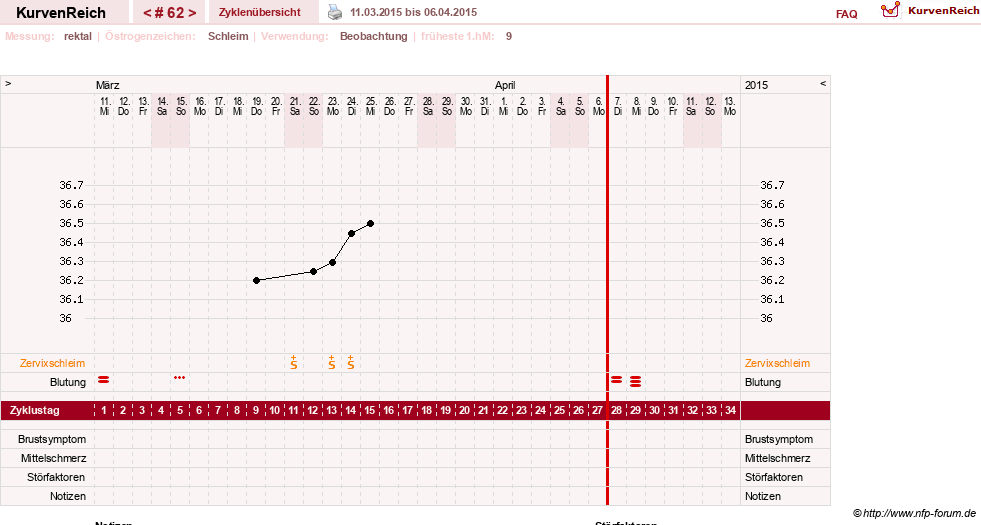NFP-Kurve User #13804