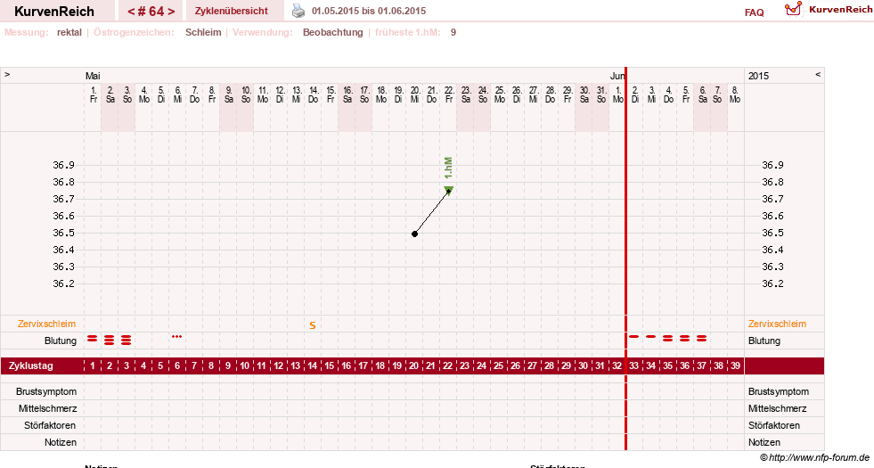 NFP-Kurve User #13804