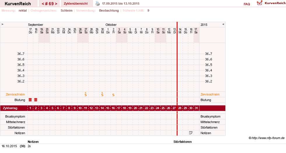 NFP-Kurve User #13804