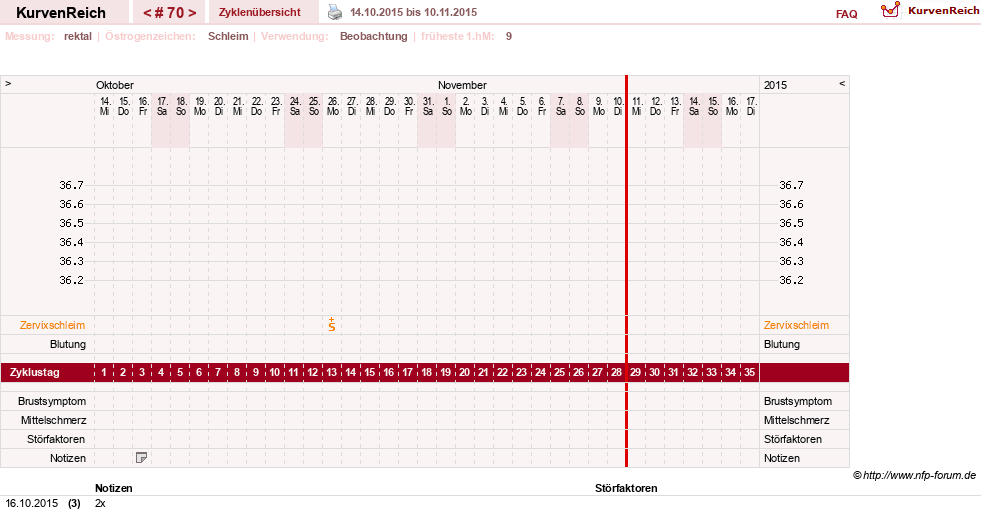 NFP-Kurve User #13804