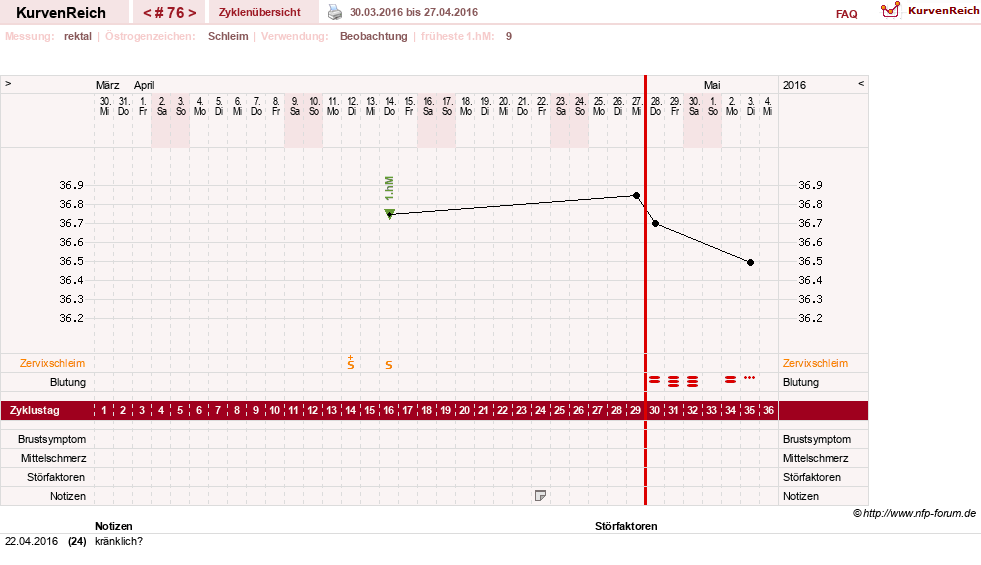 NFP-Kurve User #13804