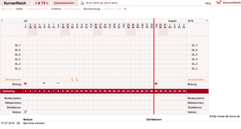 NFP-Kurve User #13804