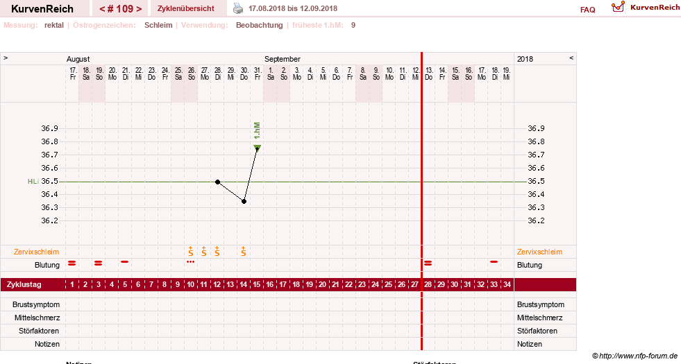 NFP-Kurve User #13804