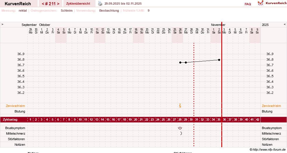 NFP-Kurve User #13804
