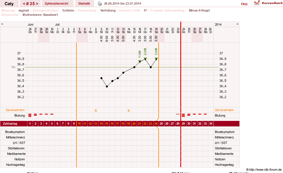 NFP-Kurve User #13821