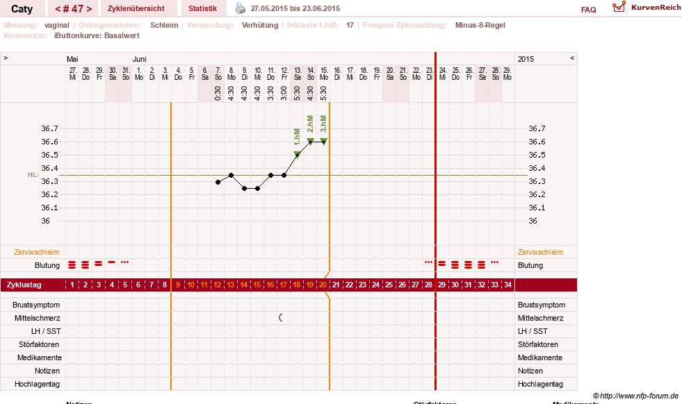 NFP-Kurve User #13821