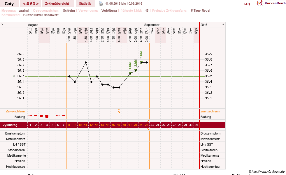 NFP-Kurve User #13821