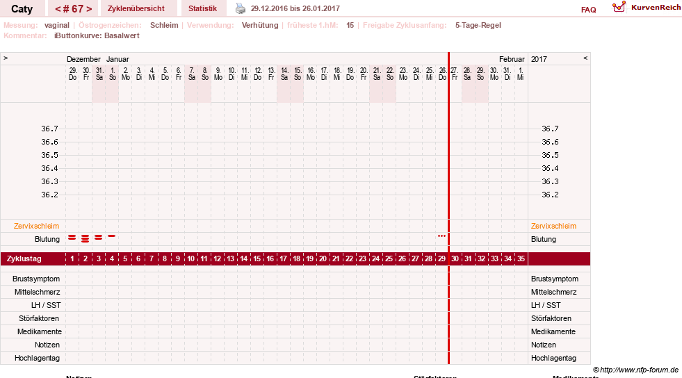 NFP-Kurve User #13821