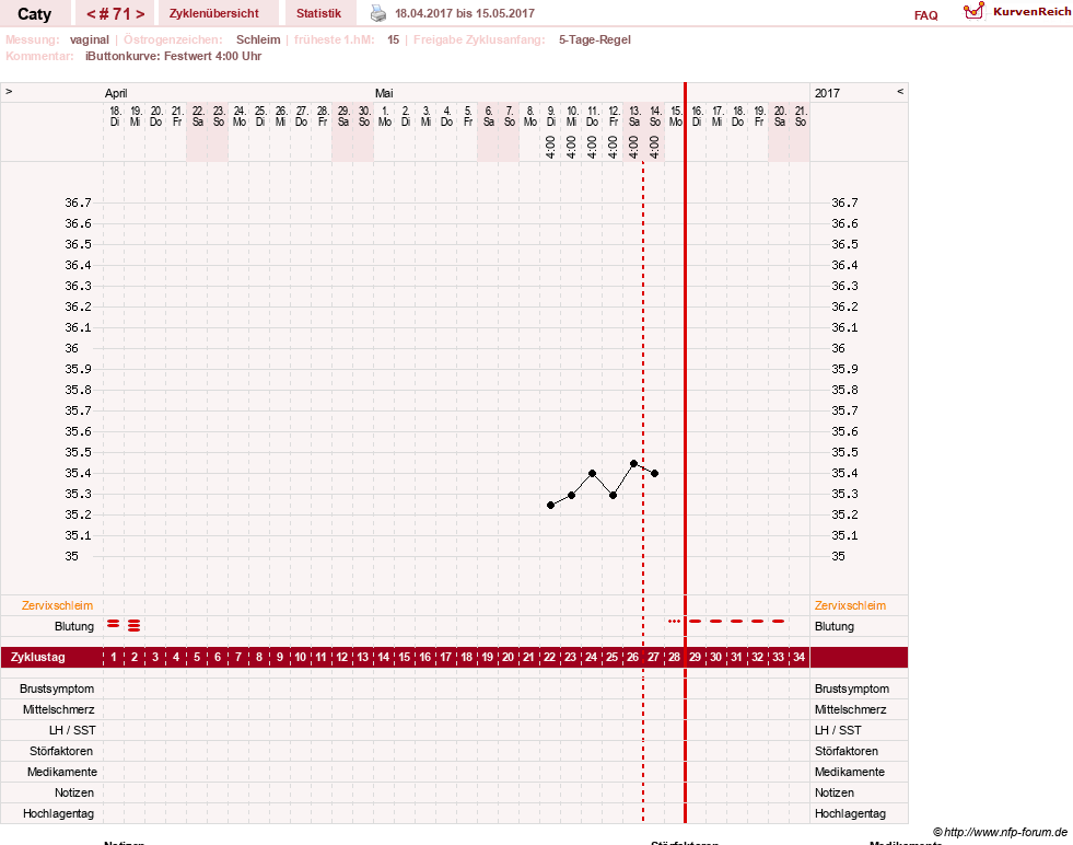 NFP-Kurve User #13821
