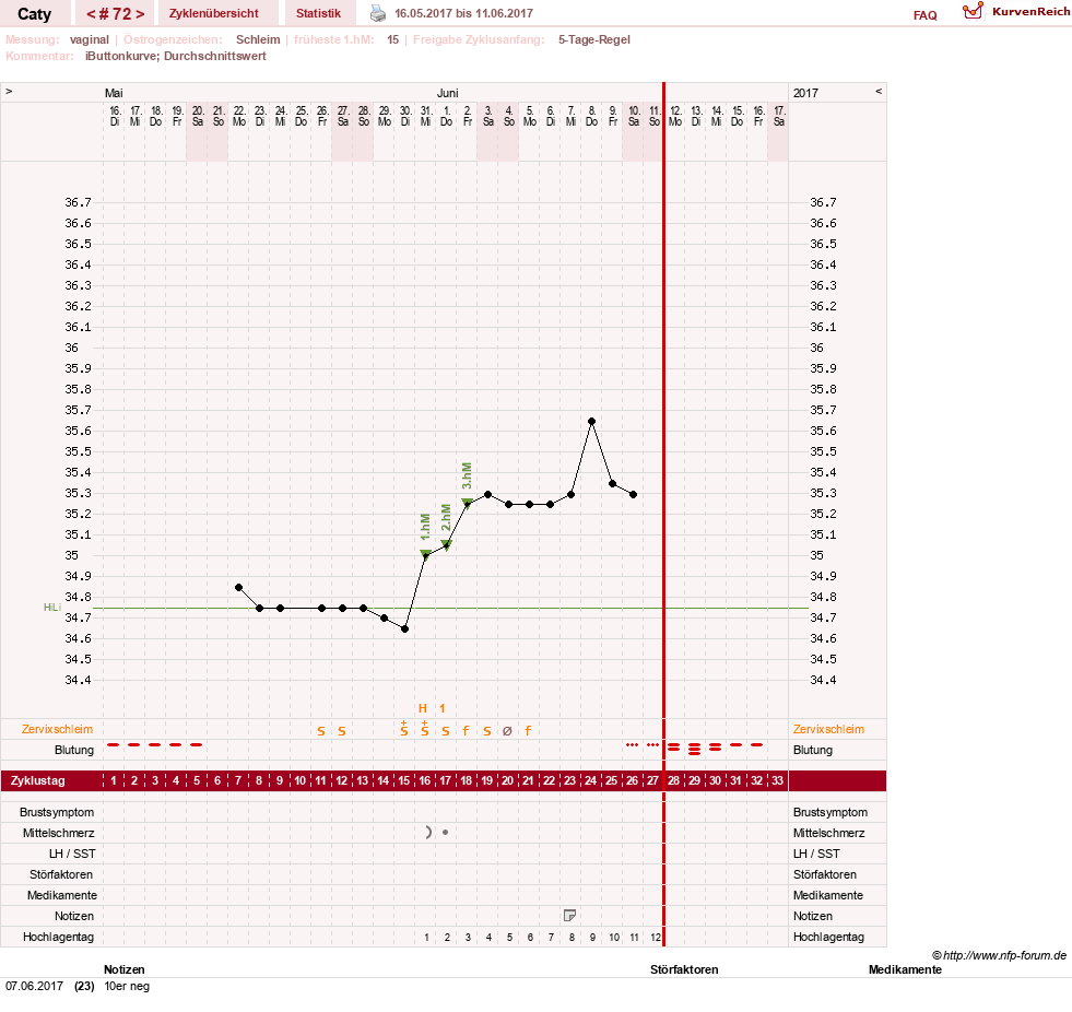 NFP-Kurve User #13821