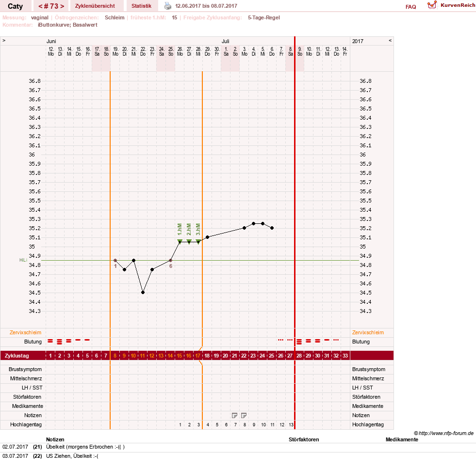 NFP-Kurve User #13821