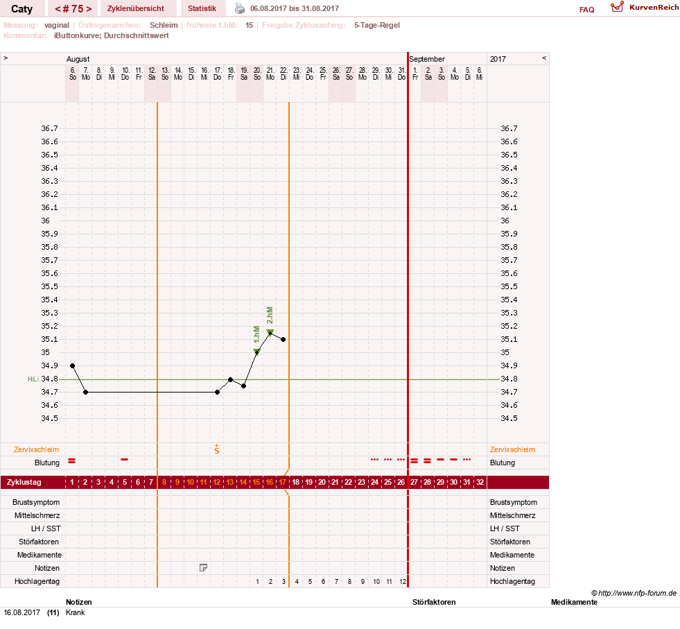 NFP-Kurve User #13821