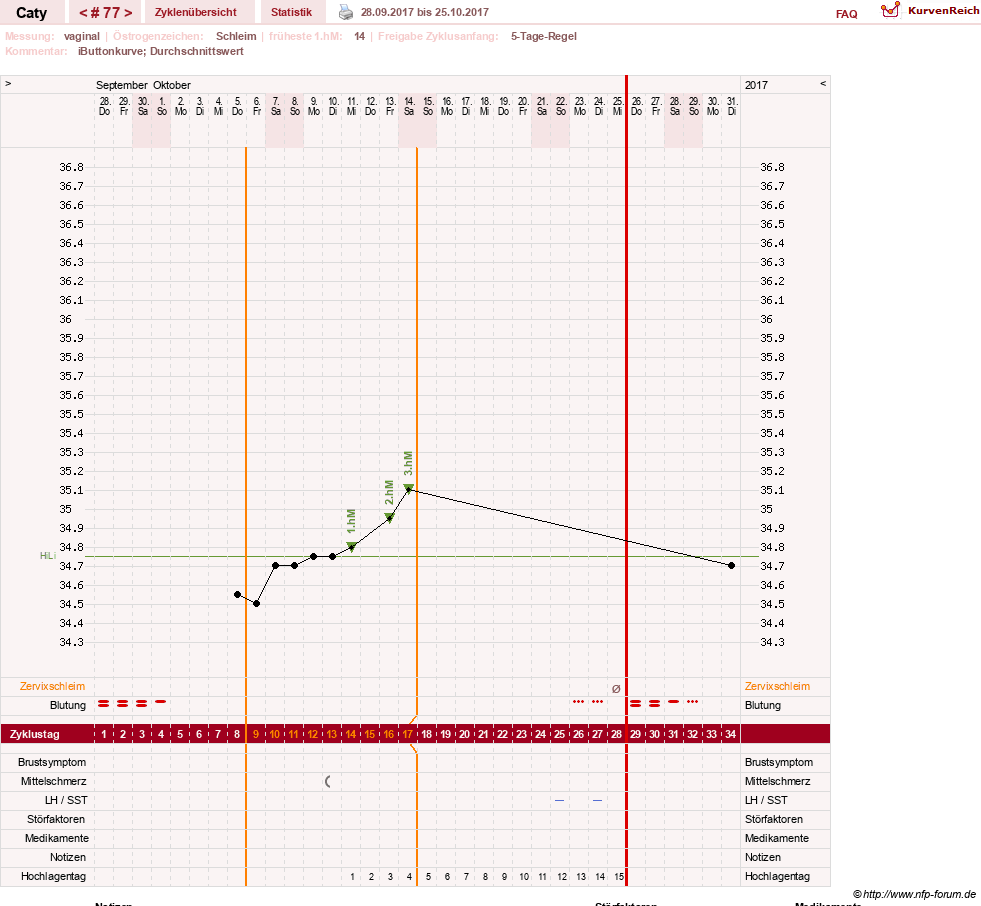 NFP-Kurve User #13821