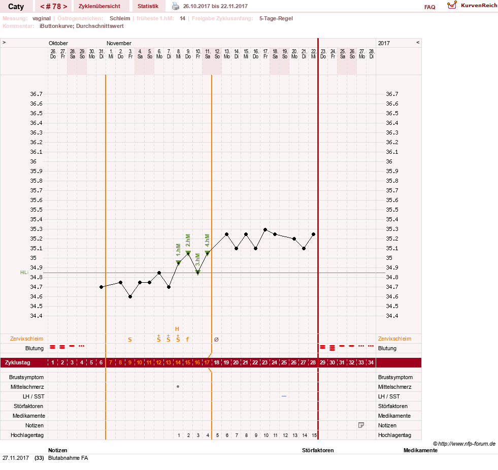 NFP-Kurve User #13821