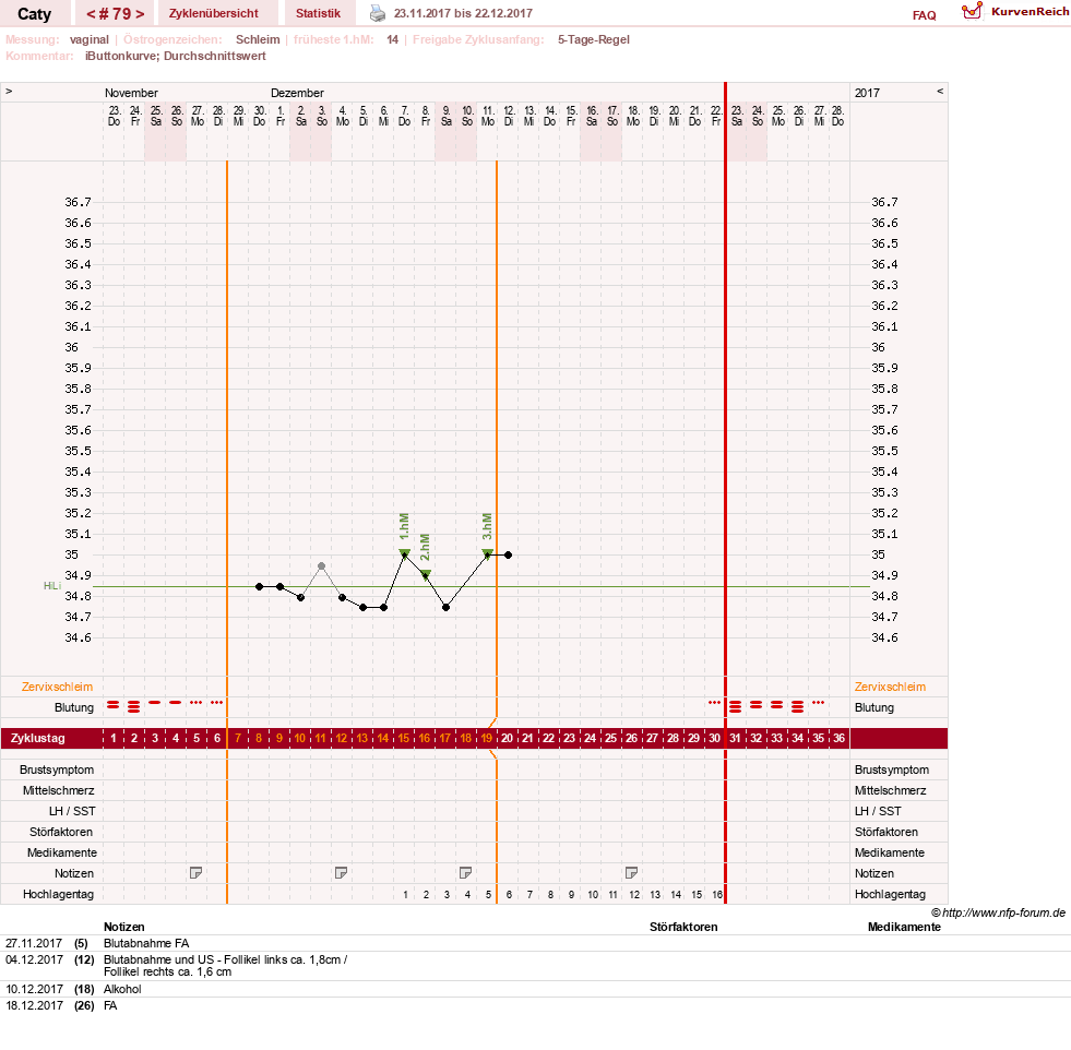 NFP-Kurve User #13821