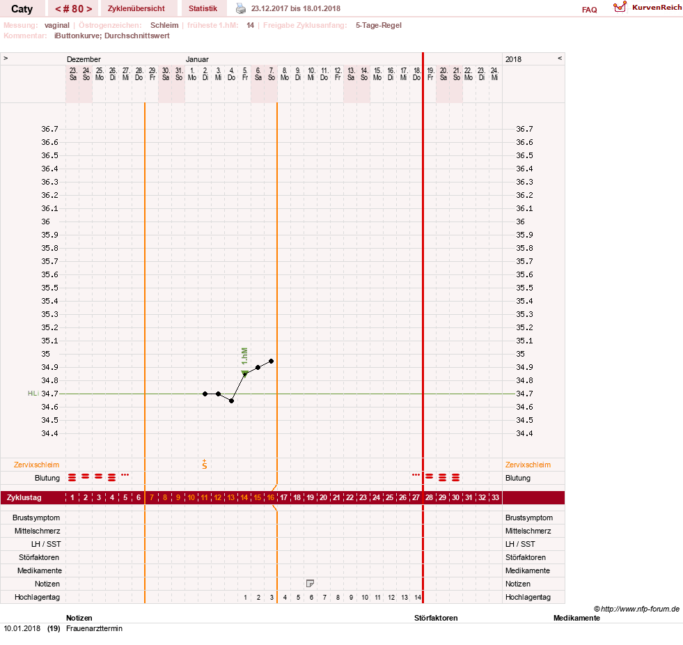 NFP-Kurve User #13821