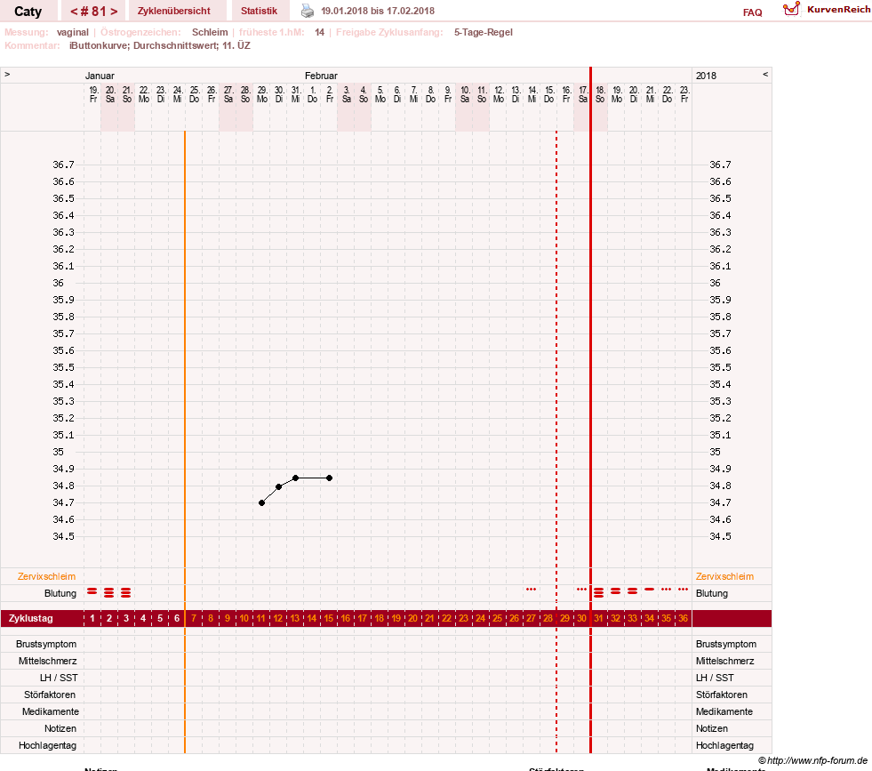 NFP-Kurve User #13821