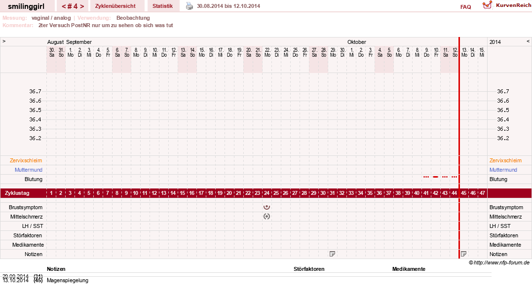 NFP-Kurve User #14051