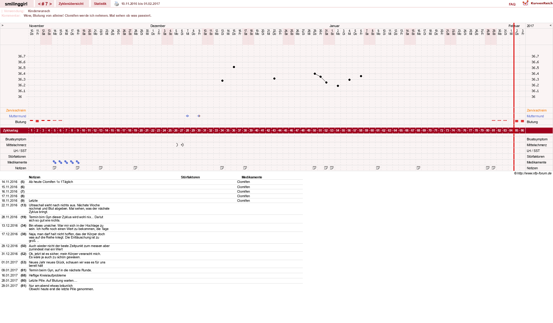 NFP-Kurve User #14051