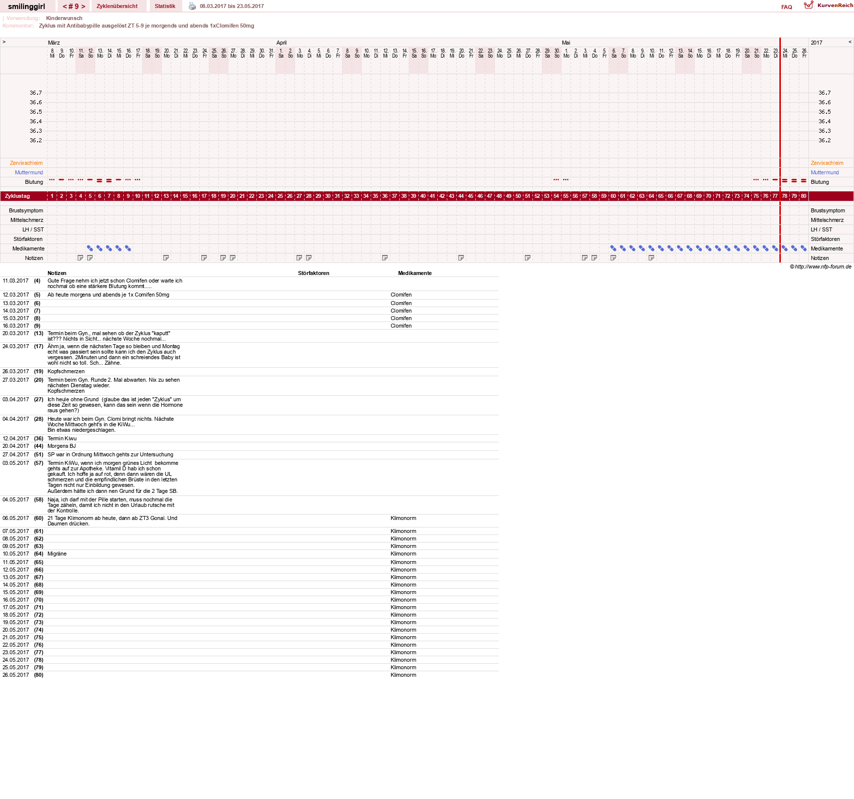 NFP-Kurve User #14051