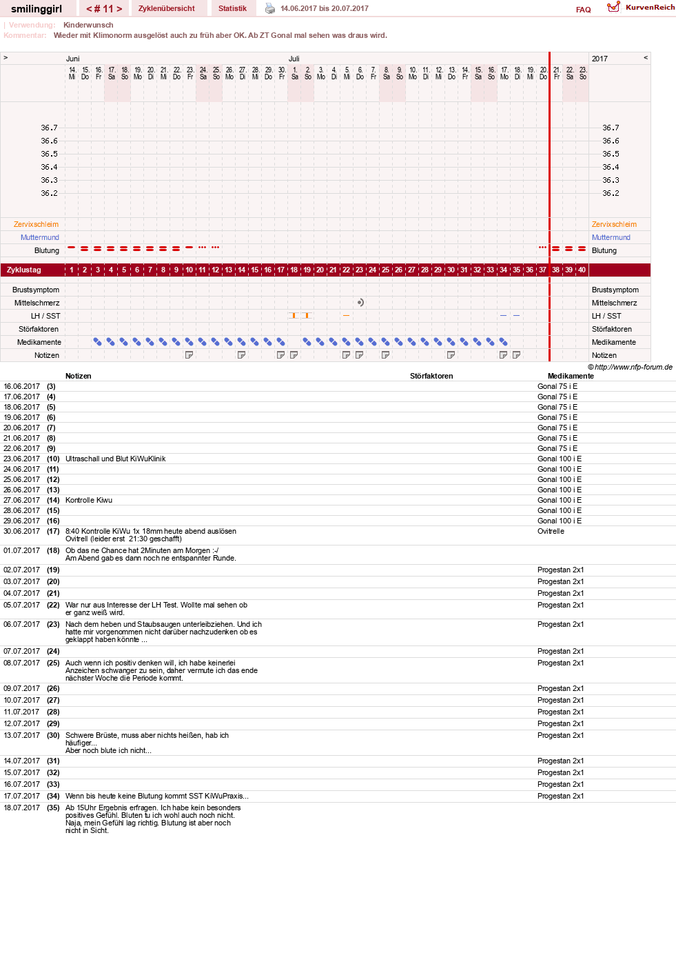 NFP-Kurve User #14051