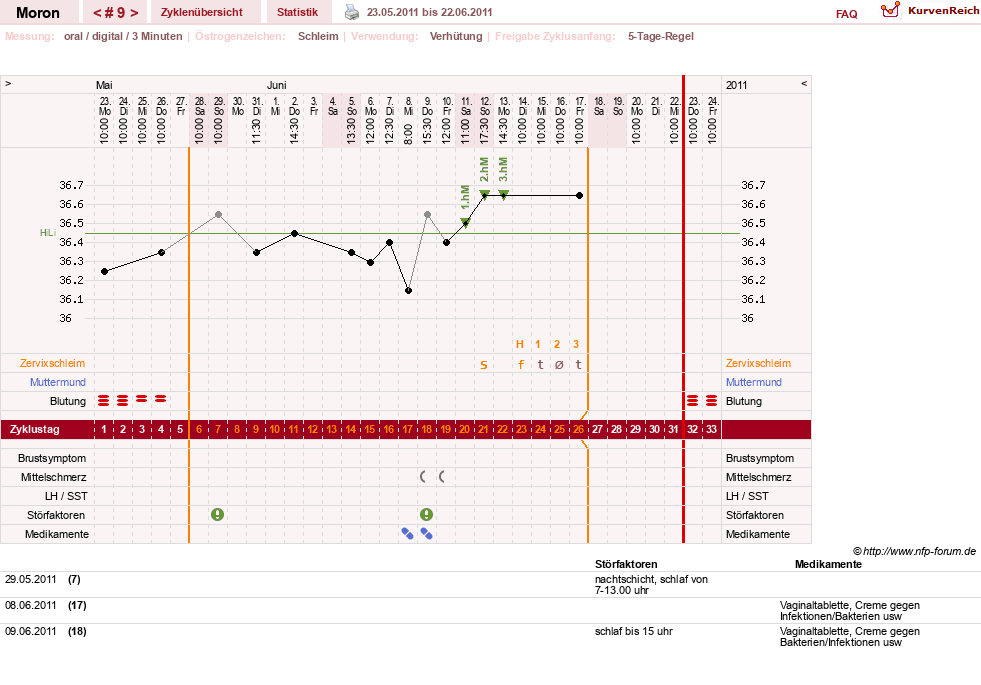 NFP-Kurve User #14070