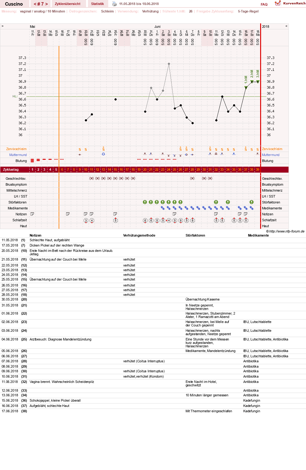 NFP-Kurve User #14156