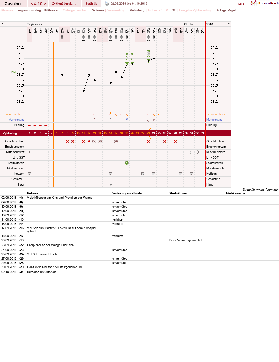 NFP-Kurve User #14156