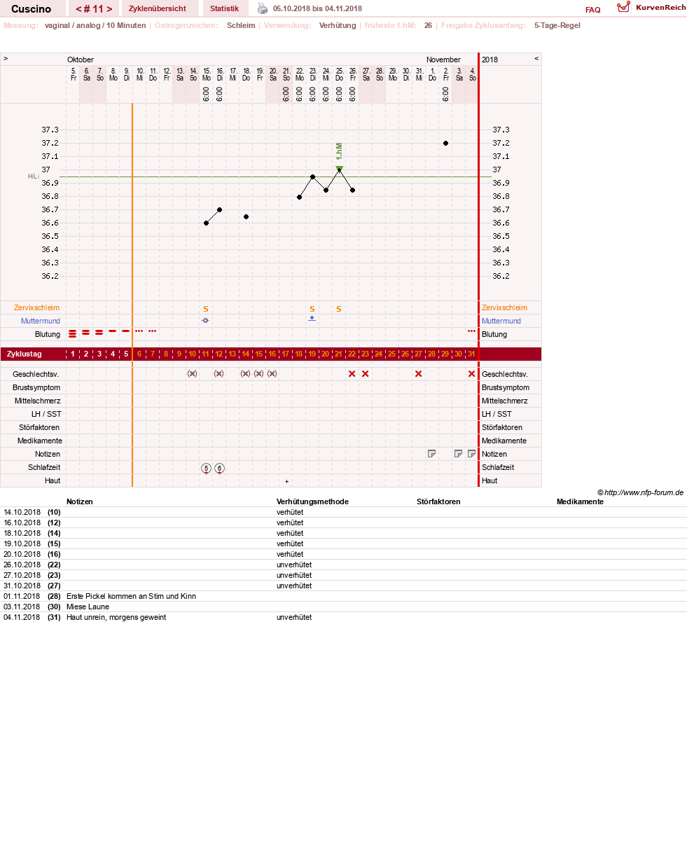 NFP-Kurve User #14156
