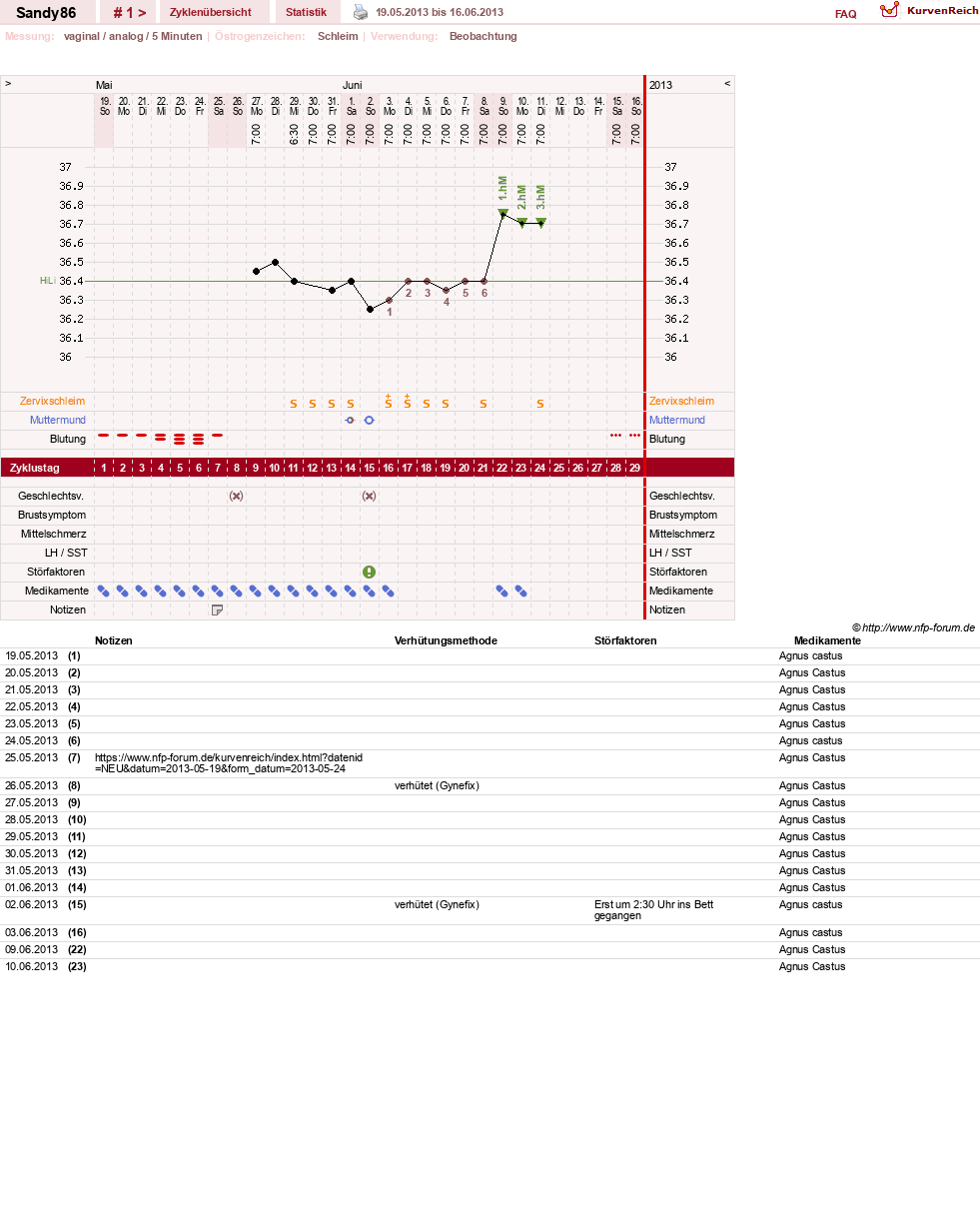NFP-Kurve User #14263