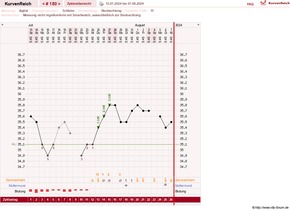 NFP-Kurve User #1428