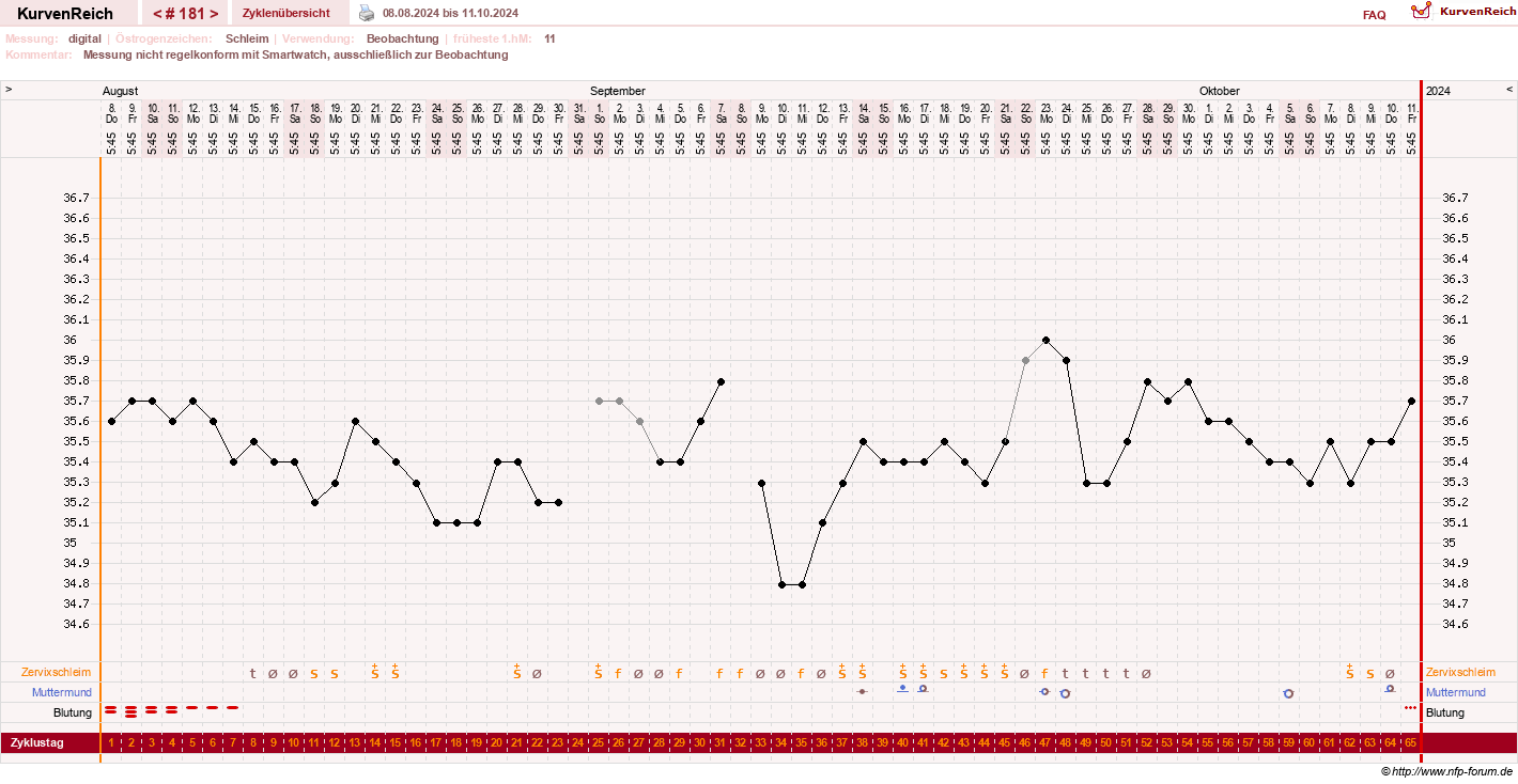 NFP-Kurve User #1428