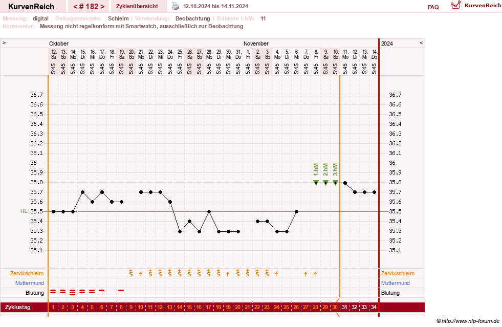 NFP-Kurve User #1428