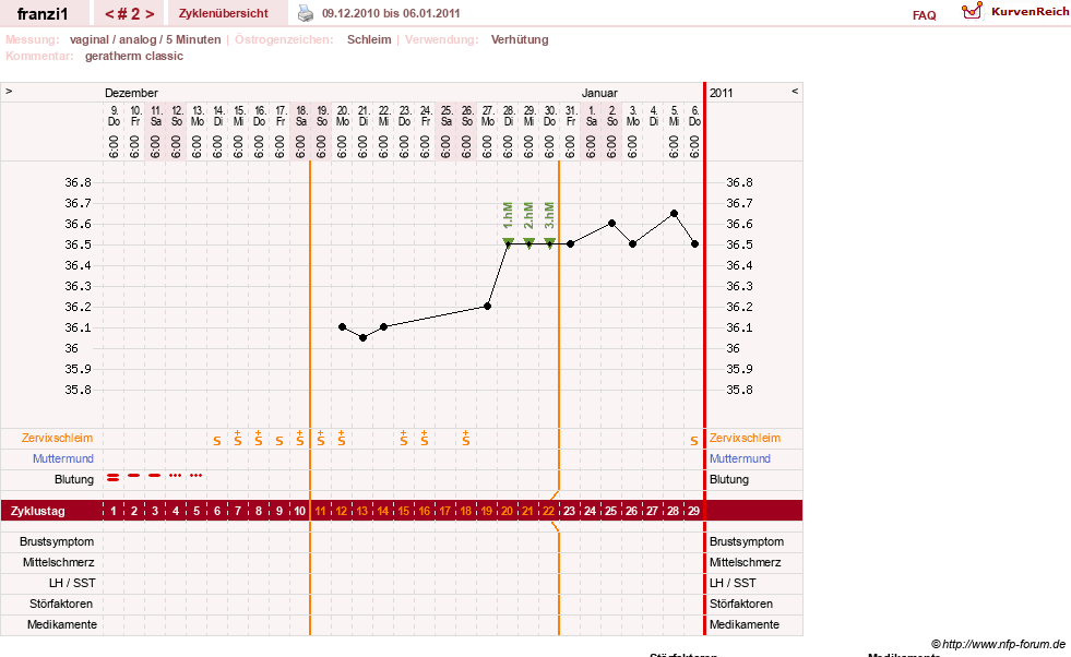 NFP-Kurve User #14300