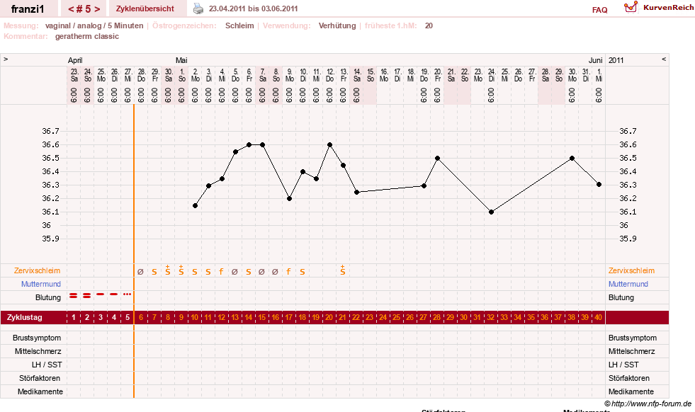 NFP-Kurve User #14300